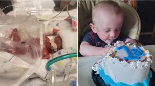 조산 당시와 돌을 맞은 현재의 리처드 모습. [기네스 월드 레코드 홈페이지 캡처]